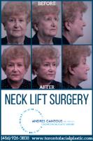 Toronto Facial Plastic Surgery image 4